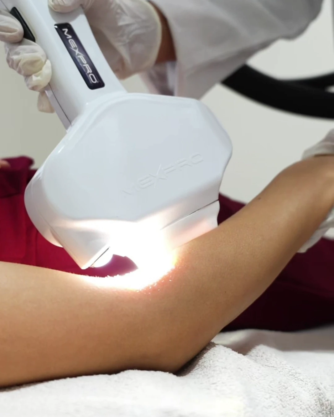 Salonda lazer epilasyon uygulaması